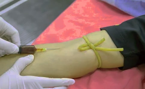 怎樣對待強迫癥患者