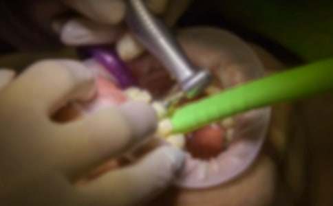 虎口拔牙的寓言故事