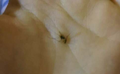 觀察蚊子作文(集錦5篇)